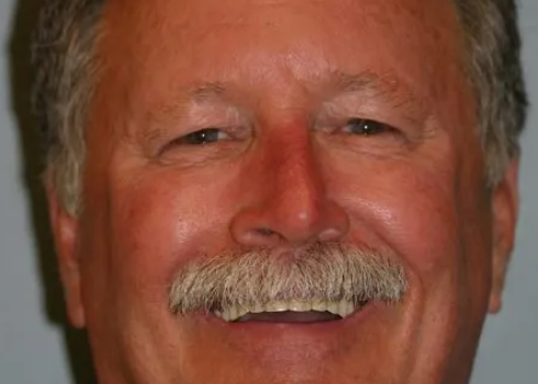 Case ron before query